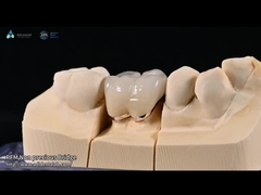 Coloração natural do dente Finê de cerâmica feldspática para dentes anteriores e posteriores