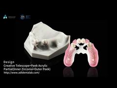 Biocompatibilidade Telescópio Dental Branco Circônio Interno Telescópio Dental