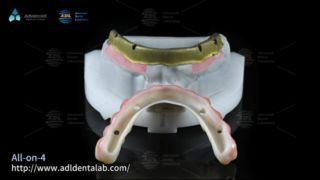 Premium Dental Restorations Fast Turnaround