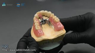 Qualidade de soldagem de precisão da coroa do telescópio