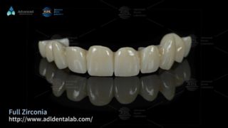 Soluções de terceirização de laboratório dentário de zircônia premium