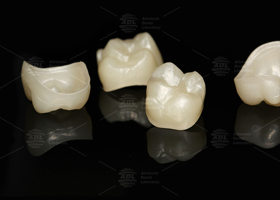 comprar Laboratório Dental de Contorno Completo Natural de Coroa de Circônio Fabricação em linha