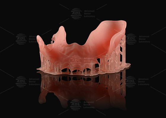 comprar Prótese parcial acrílica rosa laranja aparência natural Impressão 3D Prótese digital Fabricação em linha