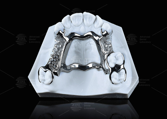 comprar Estrutura de titânio impressa em 3D de alta resistência com classes claras para desempenho durável Fabricação em linha