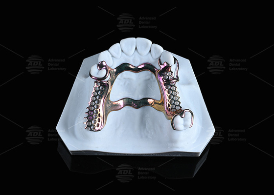 comprar Solução de estrutura de titânio de alta resistência para pele sensível Impressa em 3D Fabricação em linha