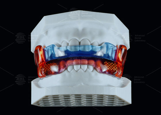 comprar Dispositivo anti-ronco de silicone de qualidade médica para melhorar o sono Fabricação em linha