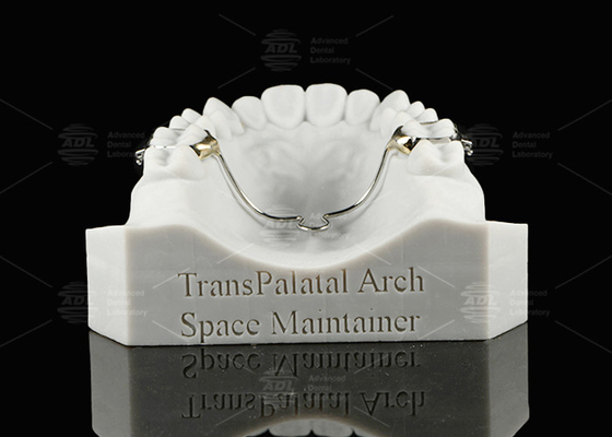 comprar ADL Arco transpalatal Manutenção de espaço Arco de manutenção de espaço removível Fabricação em linha