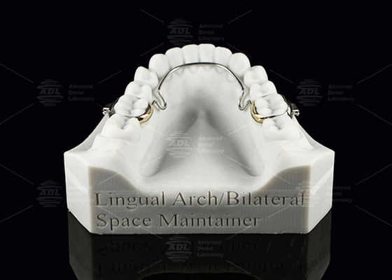 comprar Arco Lingual Mantenedor de Espaço Bilateral Dentes de aço inoxidável Mantenedores de Espaço Fabricação em linha