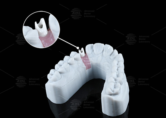 comprar Abutment de zircônio branco personalizado de aparência natural Estética e funcionalidade ótima Fabricação em linha