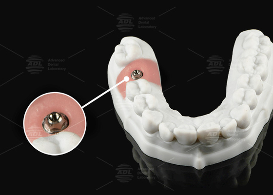 comprar Abutment multiunidade de titânio de prata-ouro para plataforma protética de unidade única ou múltipla Fabricação em linha