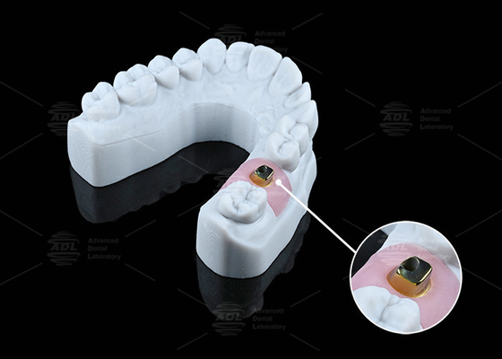 comprar Implantes e soluções dentárias à base de titânio resistentes à corrosão personalizadas Fabricação em linha