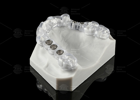 comprar Solução de implante dental transparente feito sob medida Stent cirúrgico Design ergonômico Fabricação em linha
