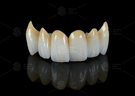 comprar Alta translucidez de contorno completo Ponte de zircônio Resistência à ruptura Estética natural Fabricação em linha