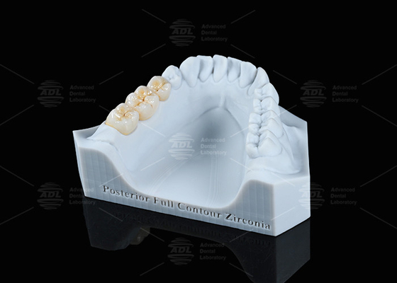 comprar Translúcida Branca de contorno completo Coroa de zircônio FCZ Coroa de zircônio monolítica Fresagem fácil Fabricação em linha