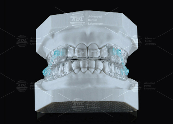comprar Silenciador Erkodent Transparente Mouthpiece Anti-Snoring Adaptação personalizada Redução de ruído Fabricação em linha
