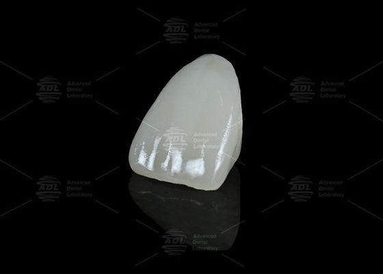 comprar Laboratório Dental China Cerâmica Híbrida Vita Enamic Dental com Translucidez para Restaurações de Dente Único Fabricação em linha