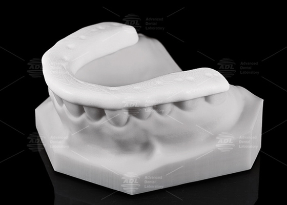 comprar Durabilidade e transpirabilidade 3D Impressão de Nylon Oclusal Splint / Night Guard para estilos de vida ativos Fabricação em linha