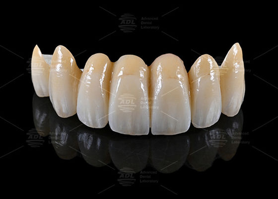 comprar Laboratório Dental da China fornecendo materiais de bloco de AIDITE ZIRCONIA juntamente com tempo de entrega em 72 horas para fabricação dental Fabricação em linha