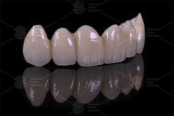 comprar Top 5 fornecedores de laboratórios dentários da China Porcelana fundida a zircônio garantindo tempo de resposta em 72 horas serviço para consultórios e laboratórios dentários Fabricação em linha