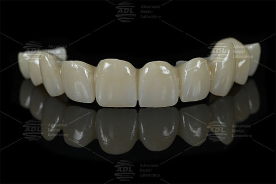 comprar Laboratório Dental da China Completo de Zirconia restaurações dentárias laboratório dentário especializado em materiais AIDITE ZIRCONIA BLOCK para soluções dentárias duráveis Fabricação em linha