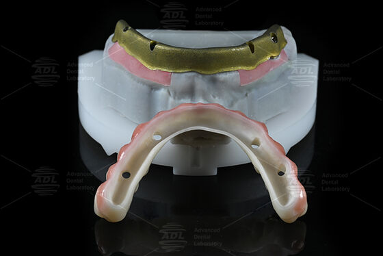 comprar Laboratório Dental da China Compatível com a maioria dos sistemas de implantes dentários Todos em 4 Oferecendo em 72 horas Tempo de resposta e Array Parâmetros técnicos Fabricação em linha