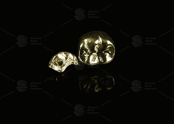 Preciosas ligas de ouro amarelo 60% coroa de metal completo ouro acabamento coroa de metal completo
