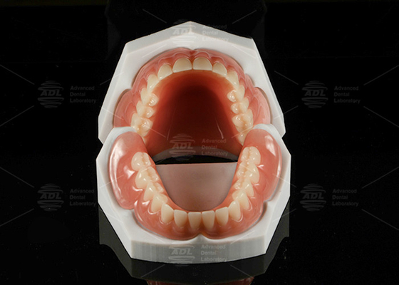 Alta estética Dentadura removível completa acrílica Dentadura completa acrílica