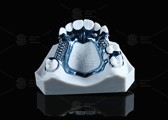 Quadro de titânio anodizado impresso em 3D leve e adequado para pele sensível