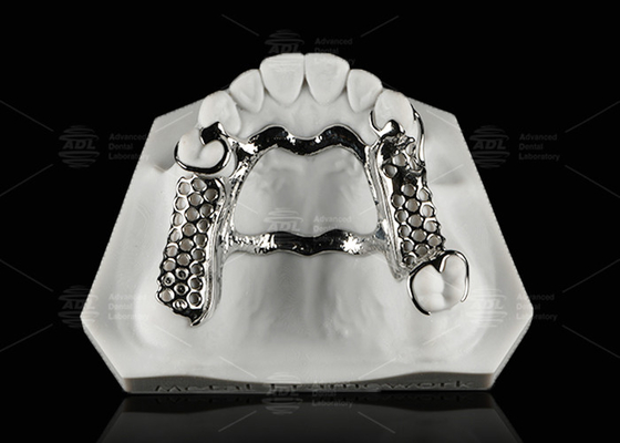 Quadro Dental de Metal de Cobalto e Cromo Reparação Dentária Parcial