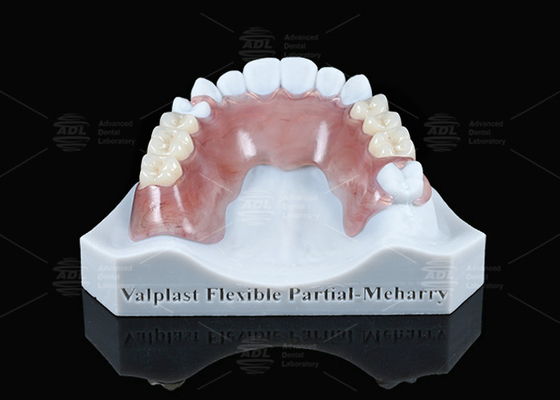 Valplast leve parcial flexível com excelente retenção