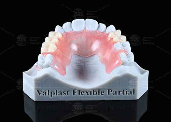 Aparência natural Valplast Dentadura parcial Longevidade Altamente resistente a fraturas