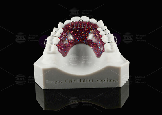 Habbit Ortodontia Linguagem Presépio Dispositivo de Presépio Dental Personalizável