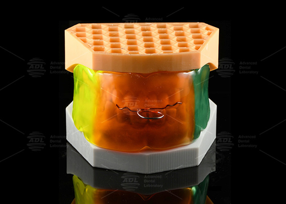 Dispositivo de proteção oral vestibular de silicone de grau médico leve