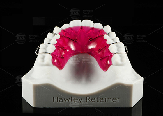Confortável Retentor Hawley de aço inoxidável acrílico Solução ortodôntica eficaz