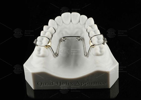 Crianças e Adolescentes Quad Helix Appliance Ortodontia Aço Inoxidável