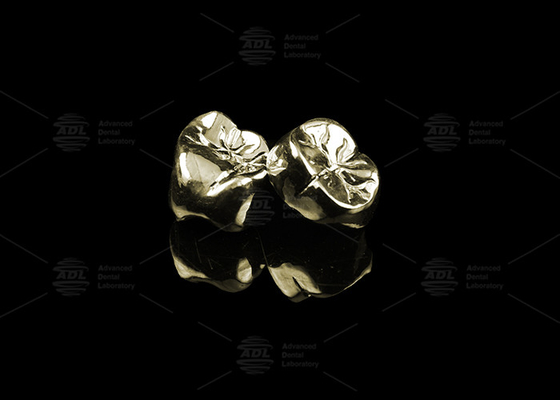 Coronha Dental de Metal Pleno Elegante de Ligação de Ouro 20% Polida