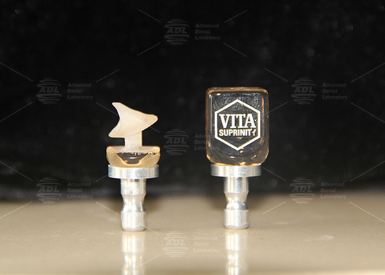 Hybrid Ceramic Vita Enamic Restaurações de Dentes Únicos com Alta Translucidez