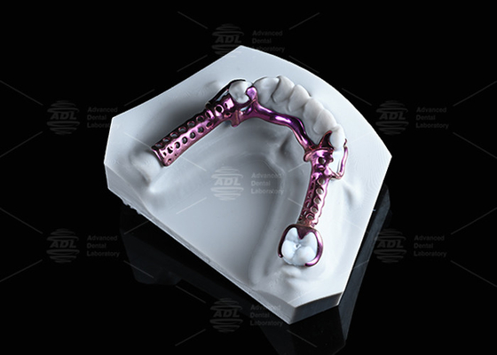Estrutura de titânio 3D anodizada de alta resistência e leveza e ajustável