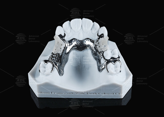FDA Vitallium Framework Com Dentes Coloridos Classes Para Estética Natural