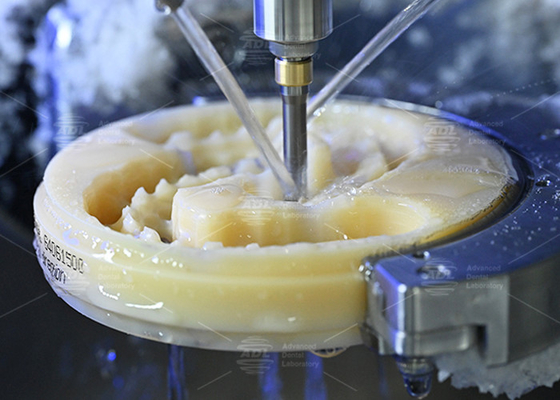 Descubra o poder da prótese dentária esteticamente agradável e de aparência natural para sorrisos perfeitos