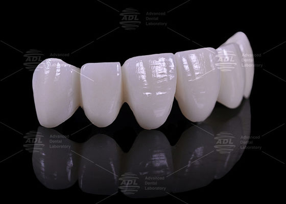 Preços competitivos com descontos de volume Laboratório Dental que oferece 16 tons de próteses dentárias adaptadas à indústria médica