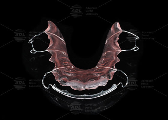 Retentor Hawley de Aço Inoxidável e Acrílico para Tratamento Ortodôntico de Laboratório Dental da China