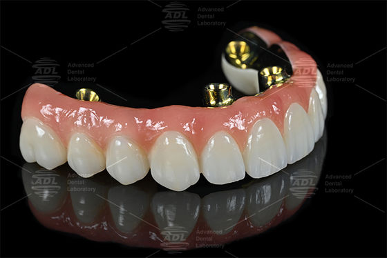 Serviços de terceirização de laboratórios dentários profissionais que fornecem próteses dentárias precisas e soluções personalizadas para as necessidades da indústria dentária