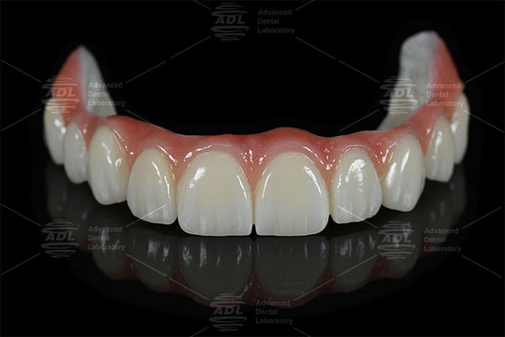 China Dental Lab Titanium And Zirconia All on X in 16 shades including A1 A2 A3 from dental lab for natural dental aesthetics