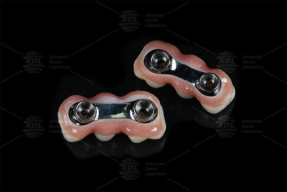 Barra de Implante de Reforço CAD CAM Projetado para ajuste de precisão Compatível com a maioria dos sistemas de implantes dentários Garante soluções de restauração dentária Laboratório dentário chinês