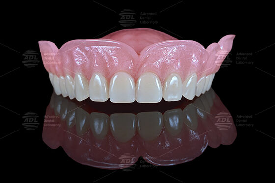 China Dental Lab Premium Removable Denture products at dental lab with multiple shipping options UPS DHL FEDEX catering to dental clinics and labs globally