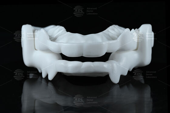 Férula Oclusal de Nylon de Grado Médico para Protección contra el Bruxismo con Diseño CAD/CAM Flexible